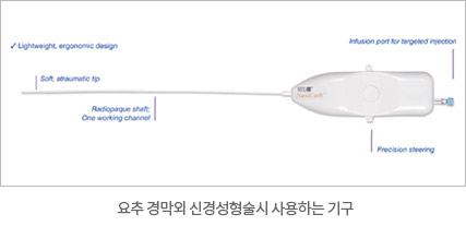 요추 경막외 신경성형술시 사용하는 기구